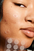 Hydrocolloid Star Pimple Patches – 480Pack